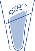 扁平足のイラスト