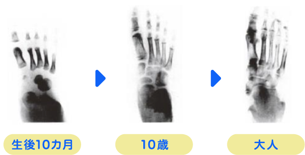 子どもの足は柔軟で形が変わりやすい