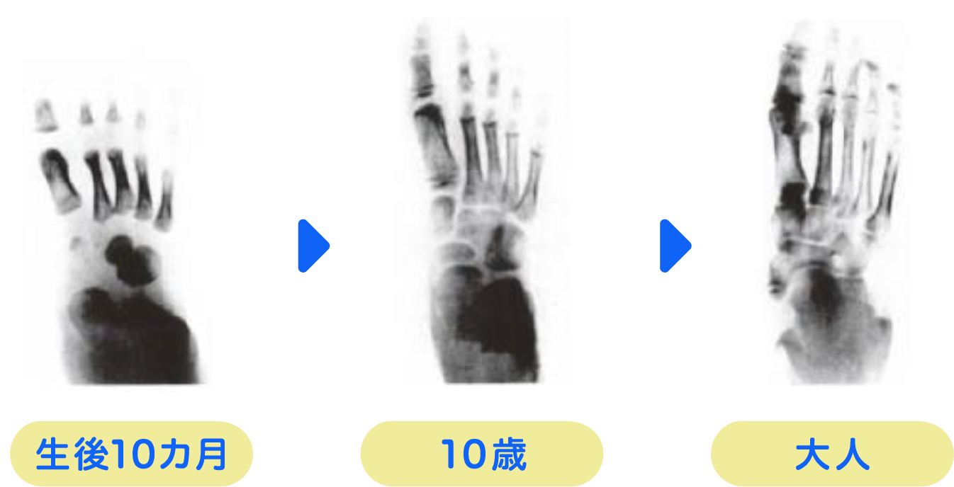 子どもの足は柔軟で形が変わりやすい